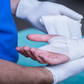 The Advantages of Consulting a Wound Care Specialist