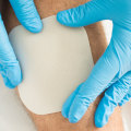 The Importance of Understanding Wound Care Management