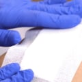 Hydrocolloid Dressing Examples for Precision and Care in Wound Assessment