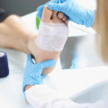 The Importance of Wound Care Clinics: A Specialist's Perspective