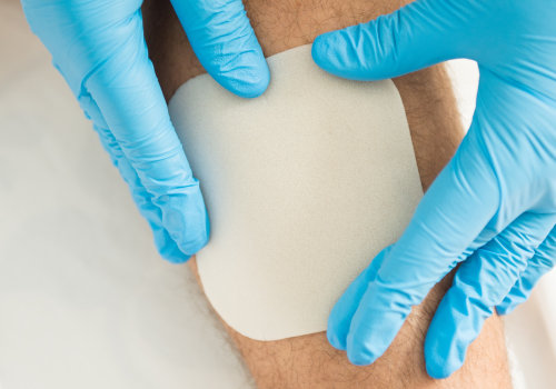 The Power of Advanced Wound Care: An Expert's Perspective