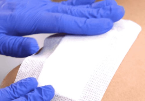 Hydrocolloid Dressing Examples for Precision and Care in Wound Assessment