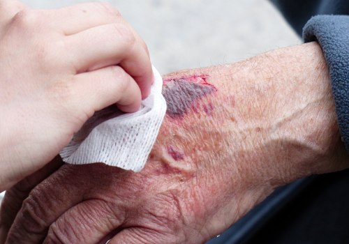 The Importance of Wound Care for Caregivers